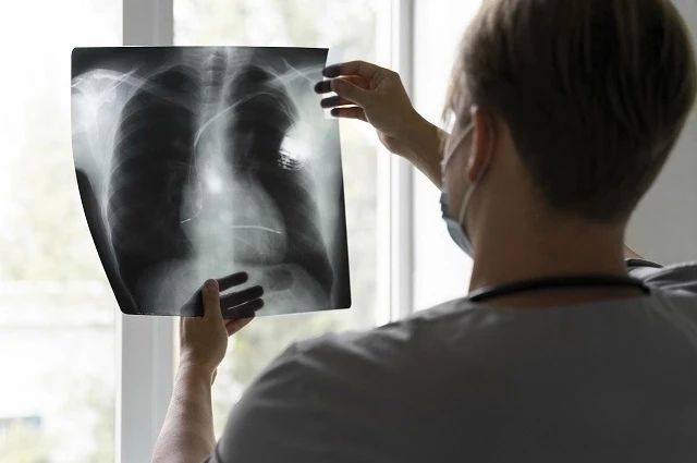 От кашля до диагноза: как не пропустить туберкулёз